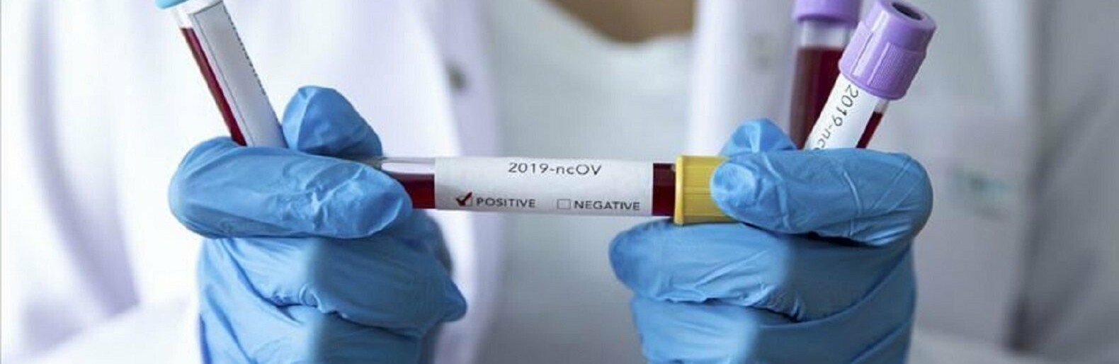  ����������� ������� ������ ���������� ���������� 