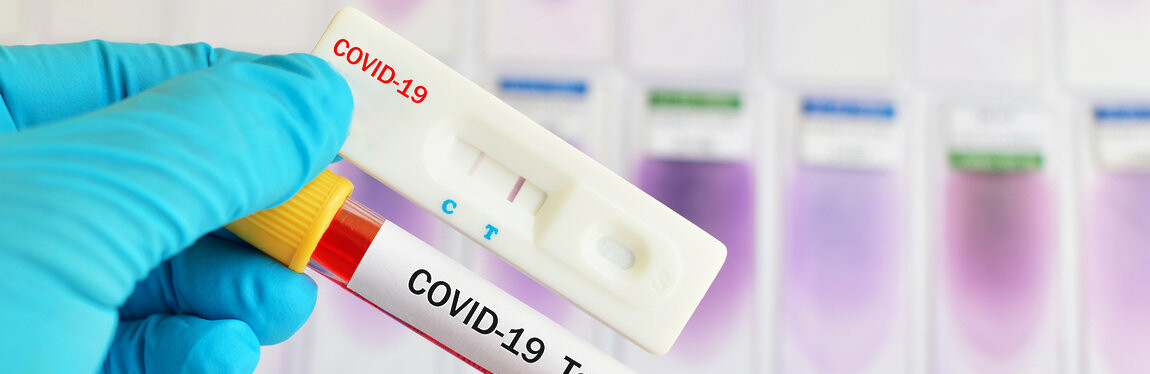  ������ 100 ��������� ������� ��������� covid-19 