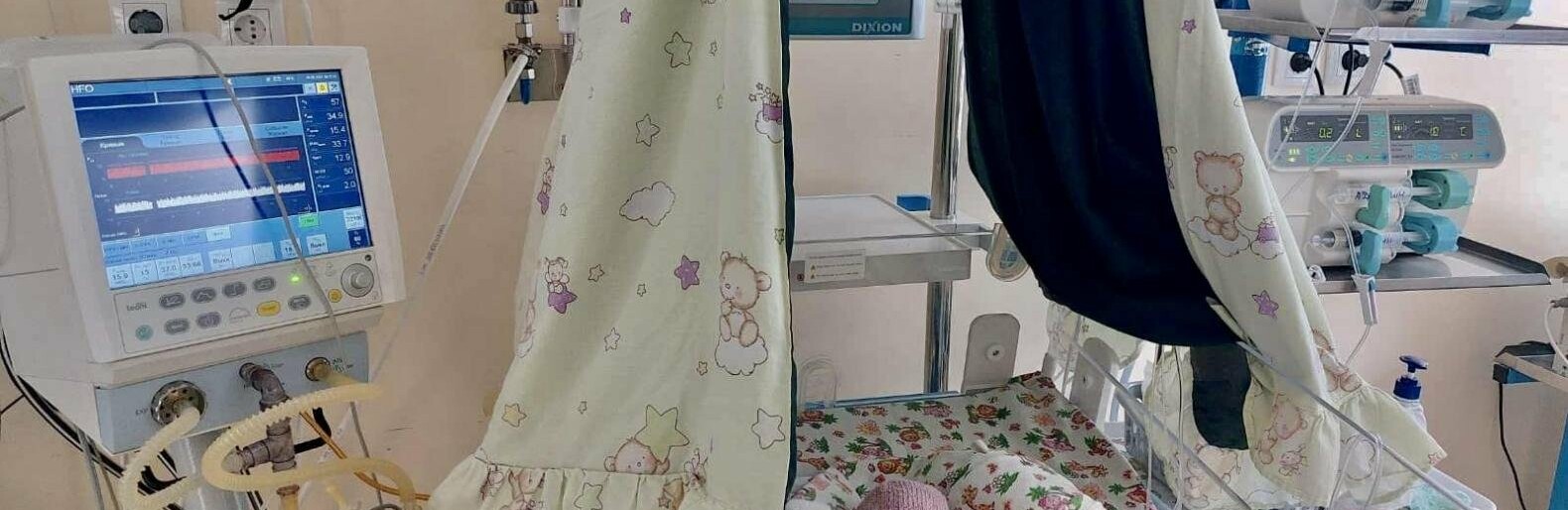 В Одесі провели операцію на серці у дитини, яка народилася передчасно, - ФОТО