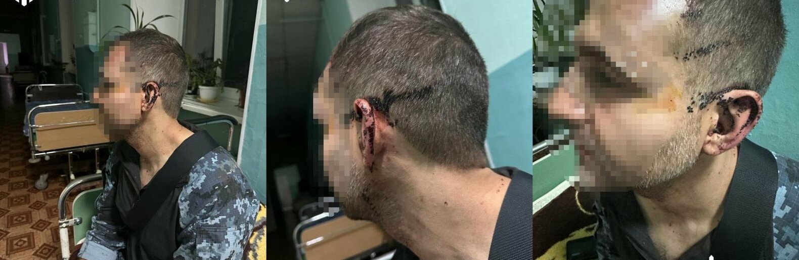У військовій частині на Одещині начальство побило підлеглого, - ФОТО 