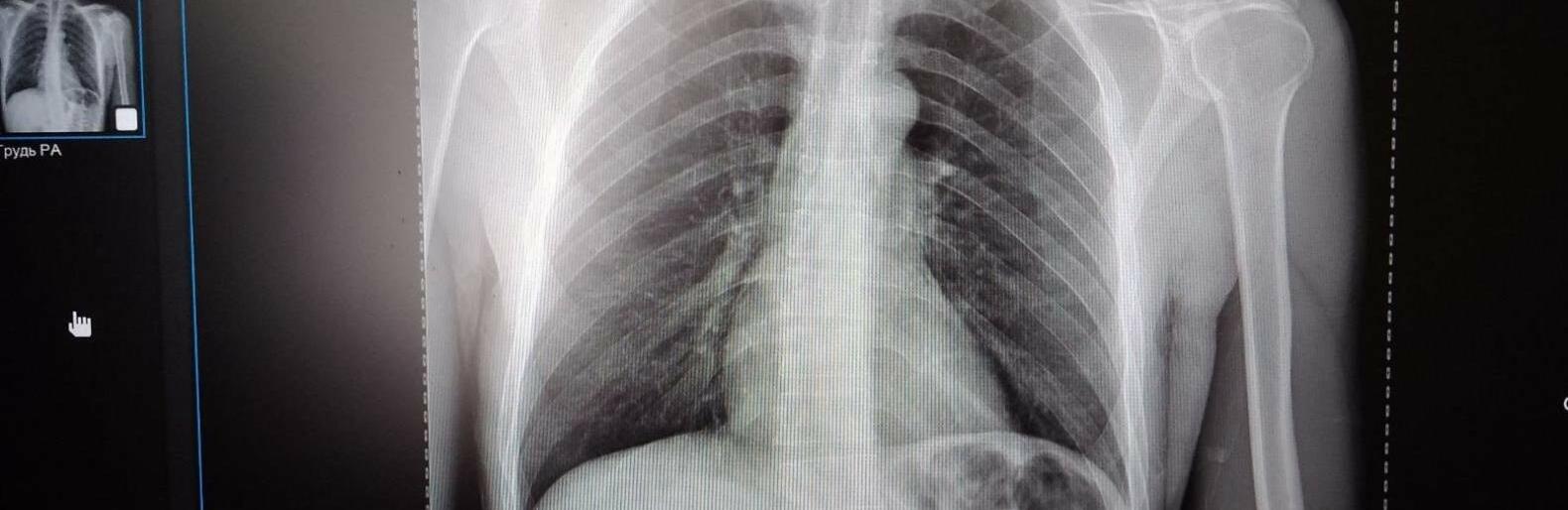 Намагався звинуватити постраждалого: в Одесі через необачного водія сильно травмувався велосипедист, - ФОТО 