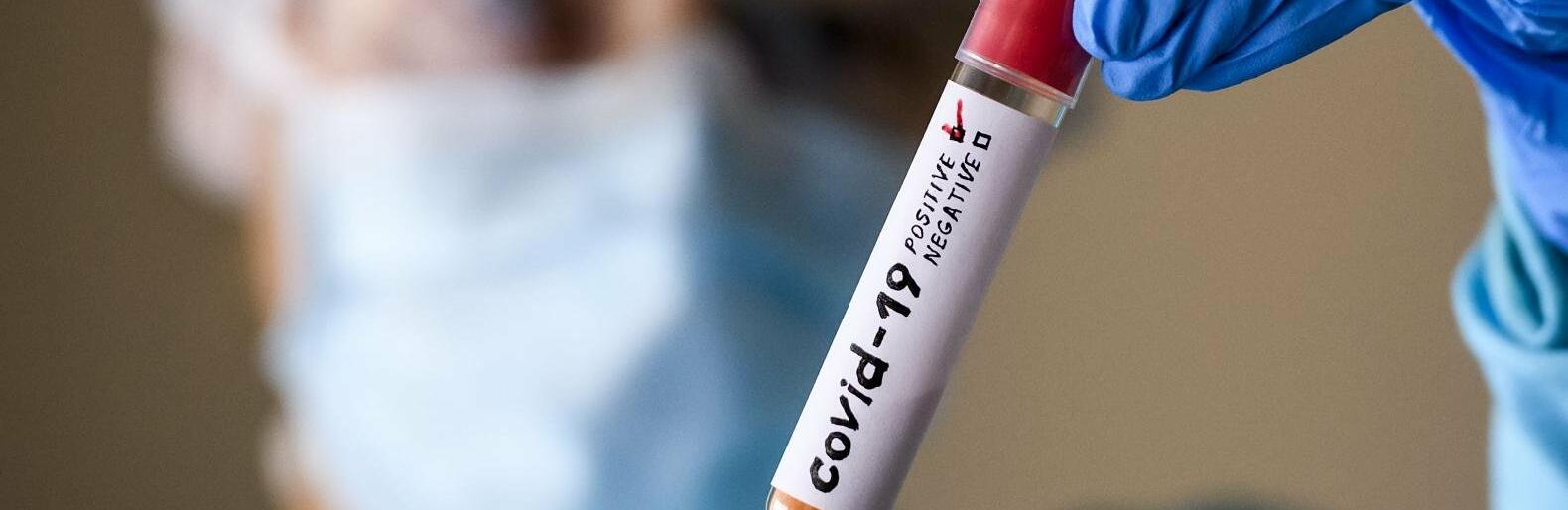 В Одесі зростає кількість хворих на COVID-19