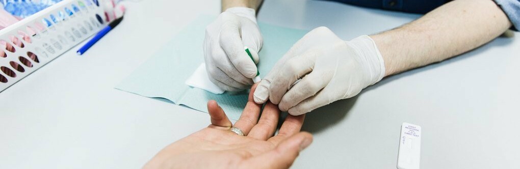 В Одесі кожен бажаючий зможе пройти безкоштовне тестування на ВІЛ та гепатити 28 липня 