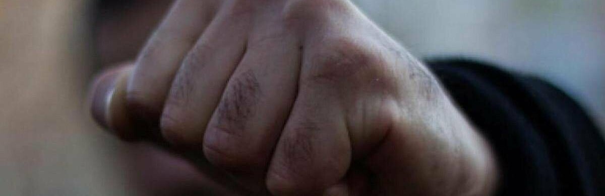 Потерпілий досі не опритомнів: 19-річний одесит побив жителя Київщини посеред вулиці 