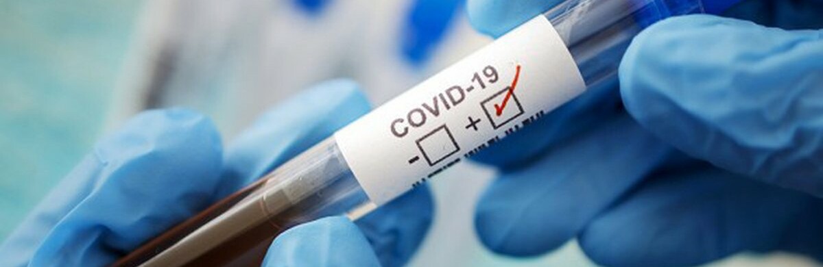 В Одесі за тиждень від COVID-19 померло двоє людей