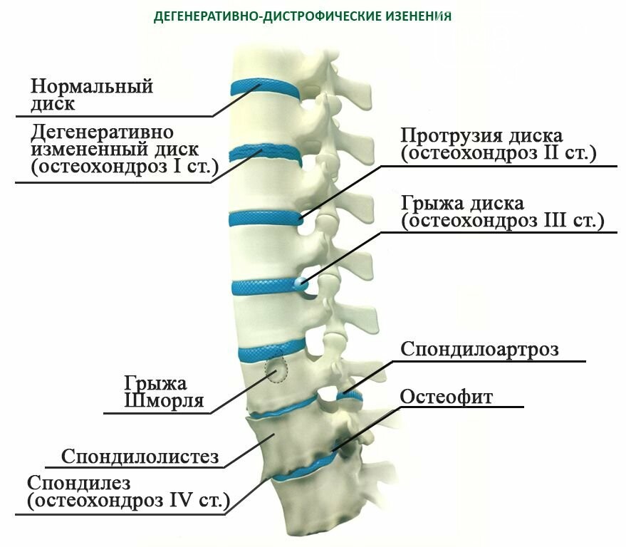 Маз для позвоночника