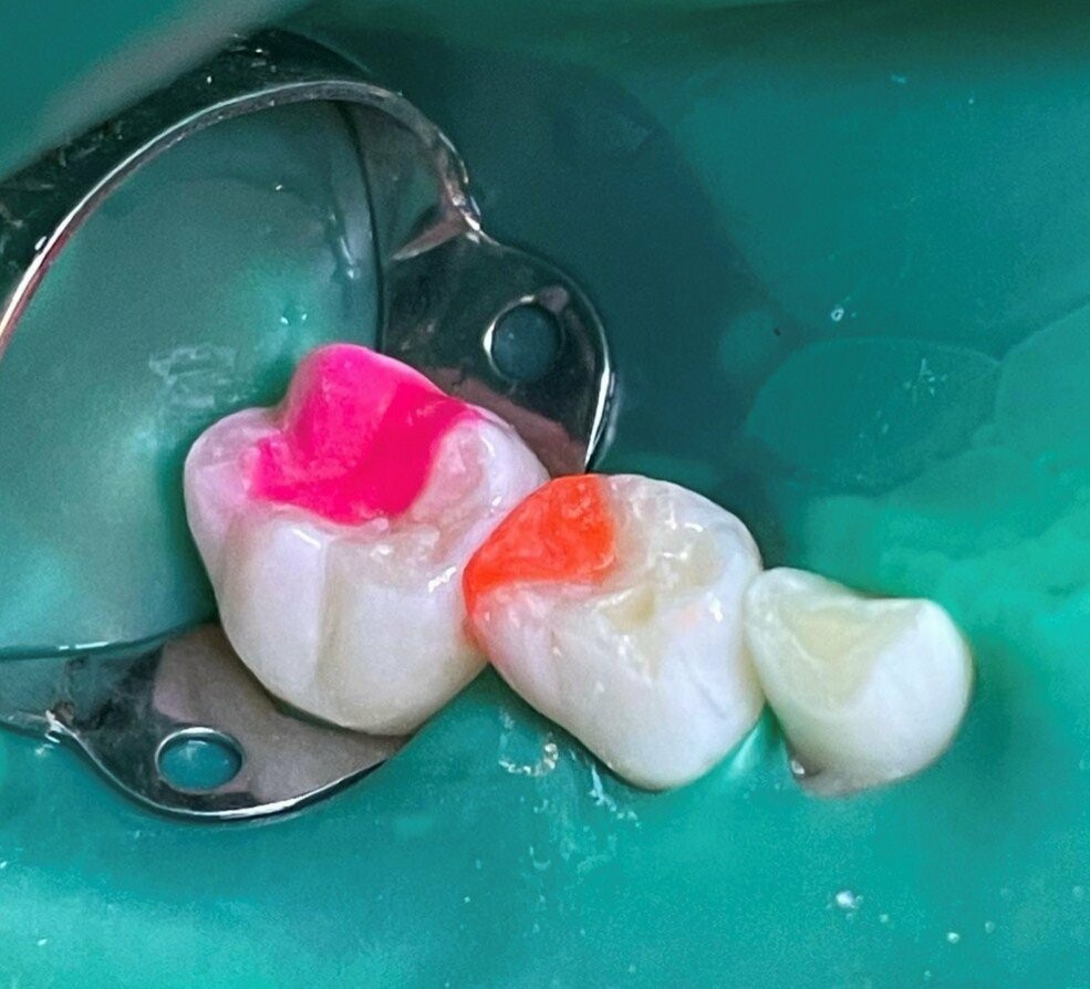 Дитяча стоматологія, фото-4