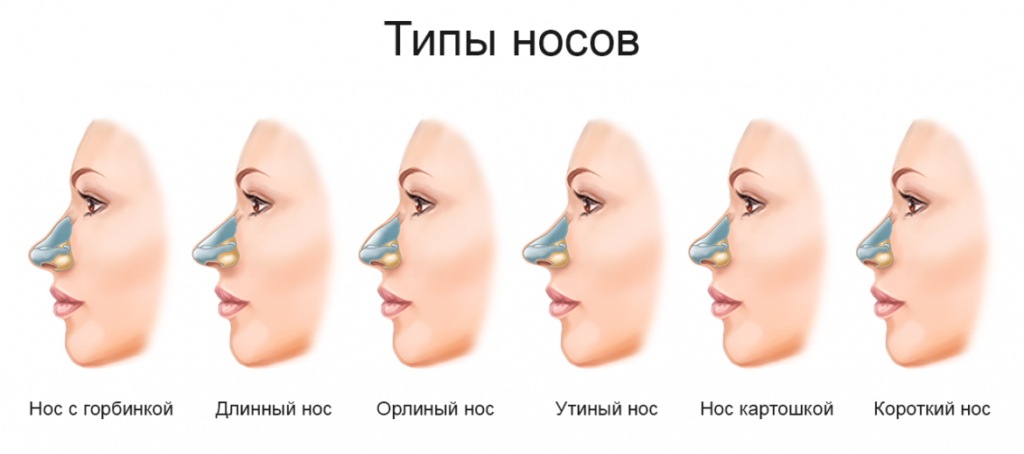  Ринопластика (пластика носа): особенности проведения и цена в Одессе