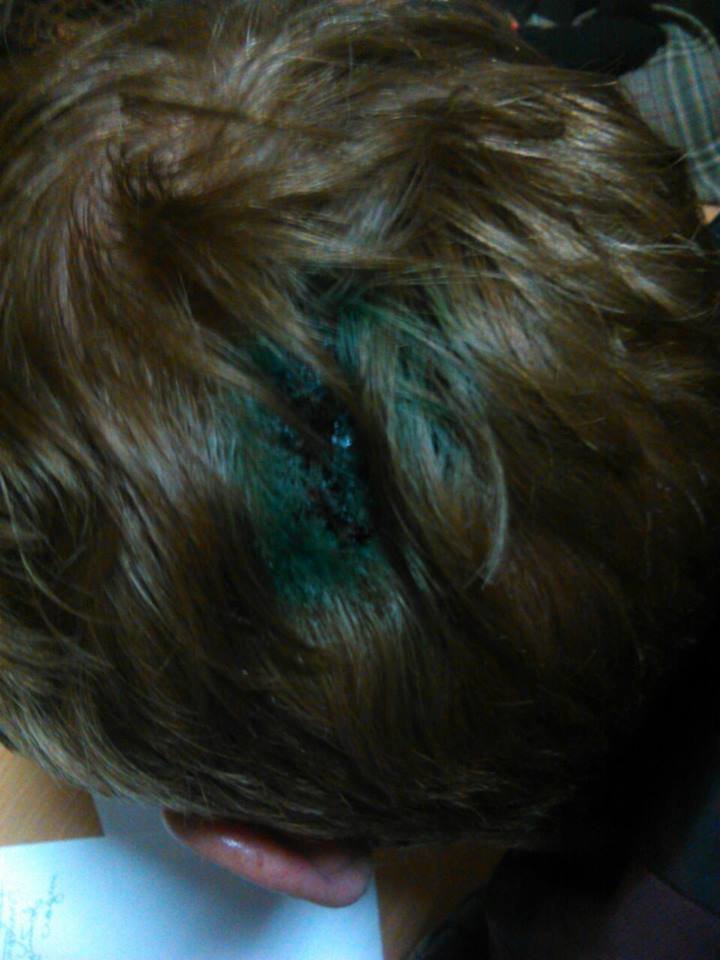 В центре Одессы семейная ссора переросла в массовую драку (ФОТО) (фото) - фото 1