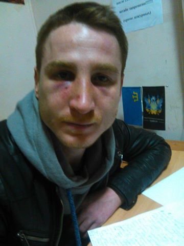 В центре Одессы семейная ссора переросла в массовую драку (ФОТО) (фото) - фото 1