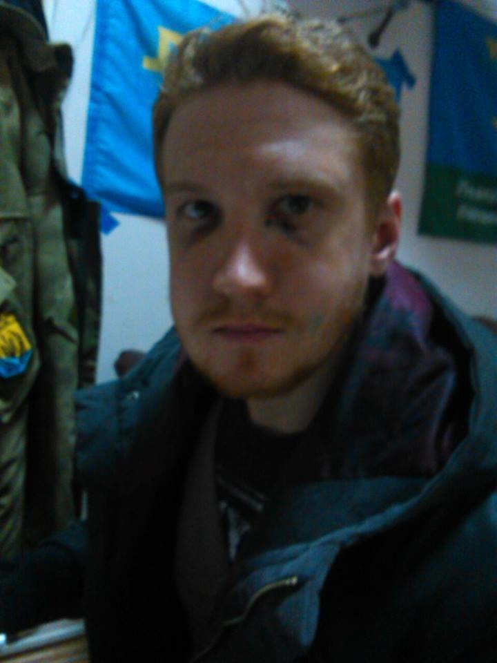 В центре Одессы семейная ссора переросла в массовую драку (ФОТО) (фото) - фото 1