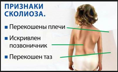 Детский остеохондроз, фото-1