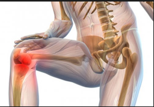 Лечение суставов, фото-1