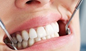 zubnoe_protezirovanie-300x199